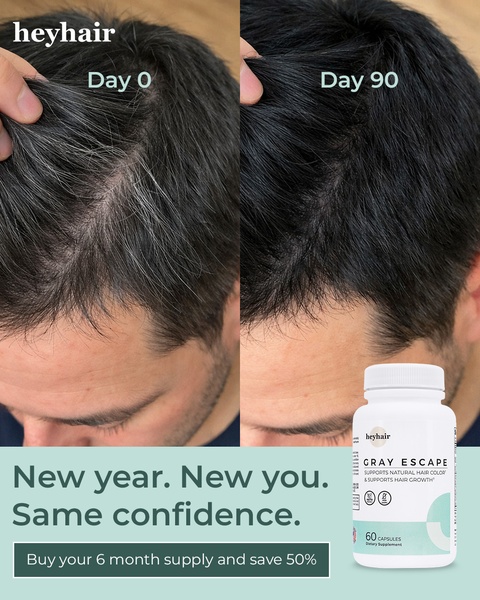 A split-screen comparison showing hair improvement after 90 days of using a dietary supplement, framed with a clear value proposition.